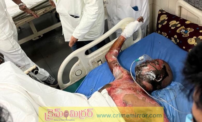 బీసీ రిజర్వేషన్‌ల సాధనకై నిప్పుంటించుకొని యువకుడు ఆత్మహత్య